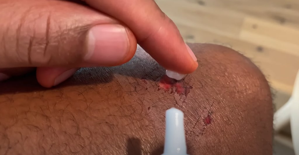 How To Use Triple Antibiotic Cream Neosporin