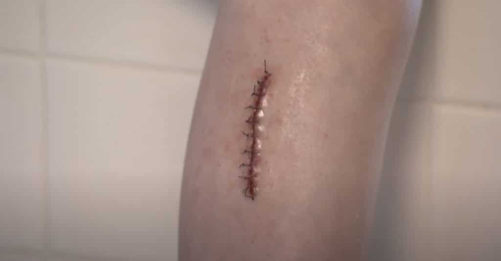 Medical Care For Injuries