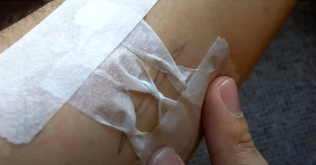 Diy Butterfly Bandage
